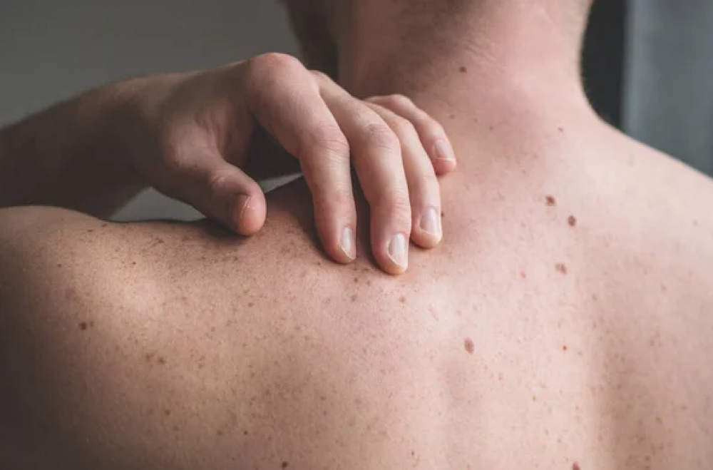 Фото ілюстративне