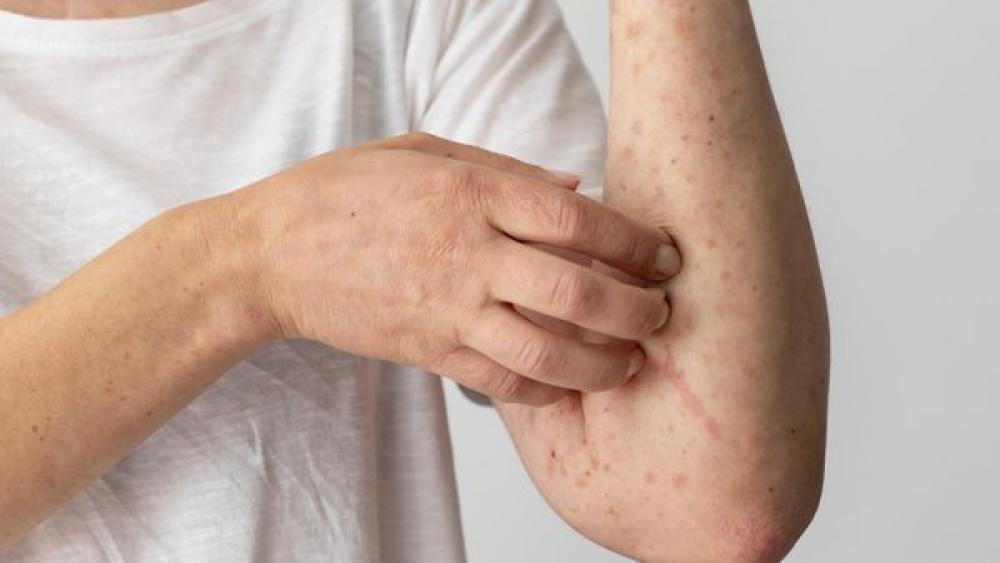 Фото ілюстративне