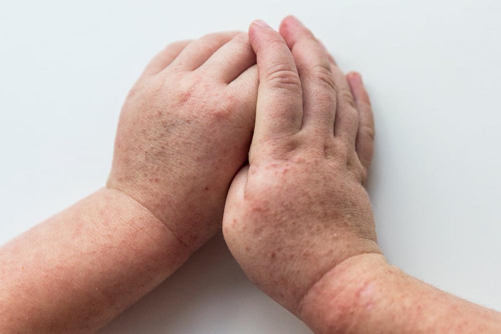 Фото ілюстративне