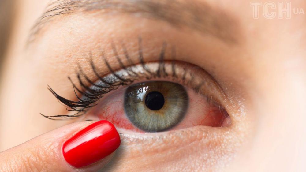 Фото ілюстративне