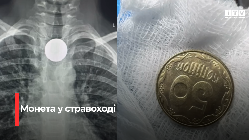 Скріншоти із відео