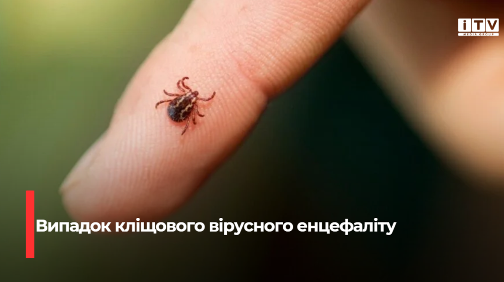 Фото ілюстративне 