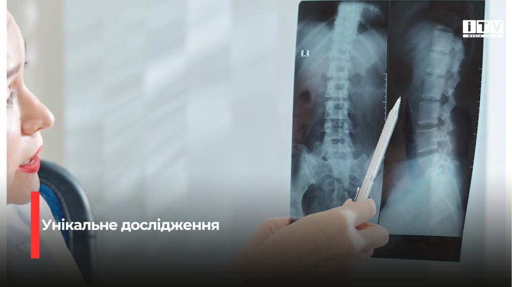 Фото ілюстративне 