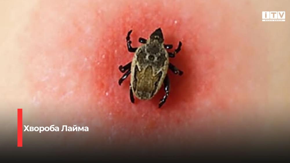 Фото ілюстративне